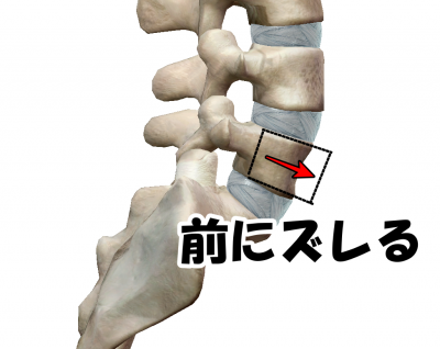 腰椎分離症、江東区、清住白河