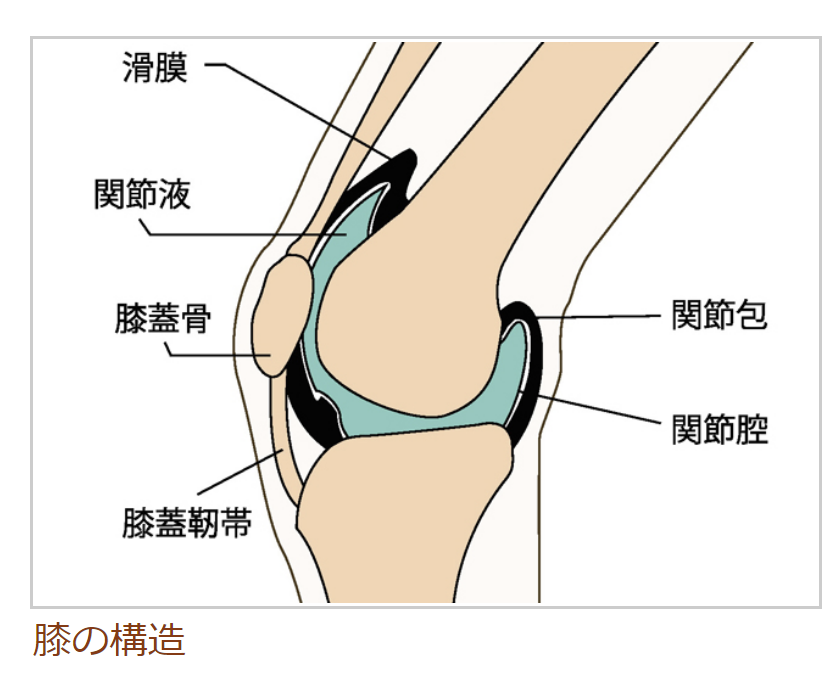 膝の裏が膨れてたら ベーカー嚢腫かも