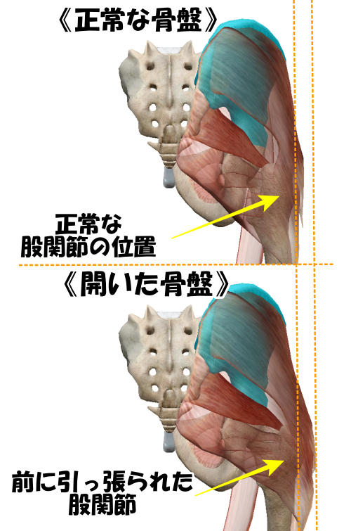 デカ尻、江東区、清澄白河、内股矯正、デカ尻、骨盤矯正