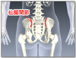 骨盤矯正の効果とは